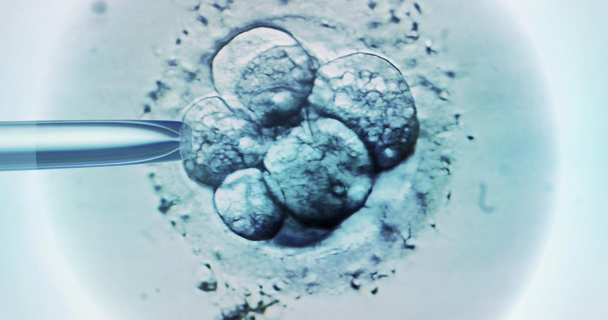 embrió IVF eljárás