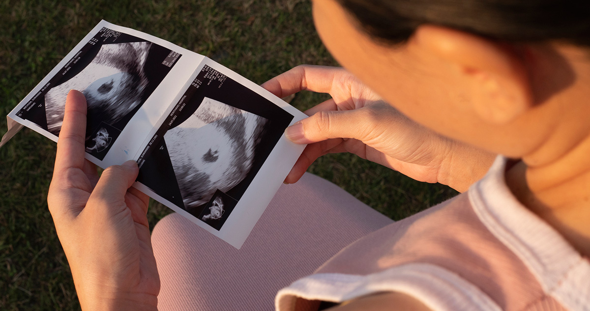 Terhes nő nézi az ultrahang képet