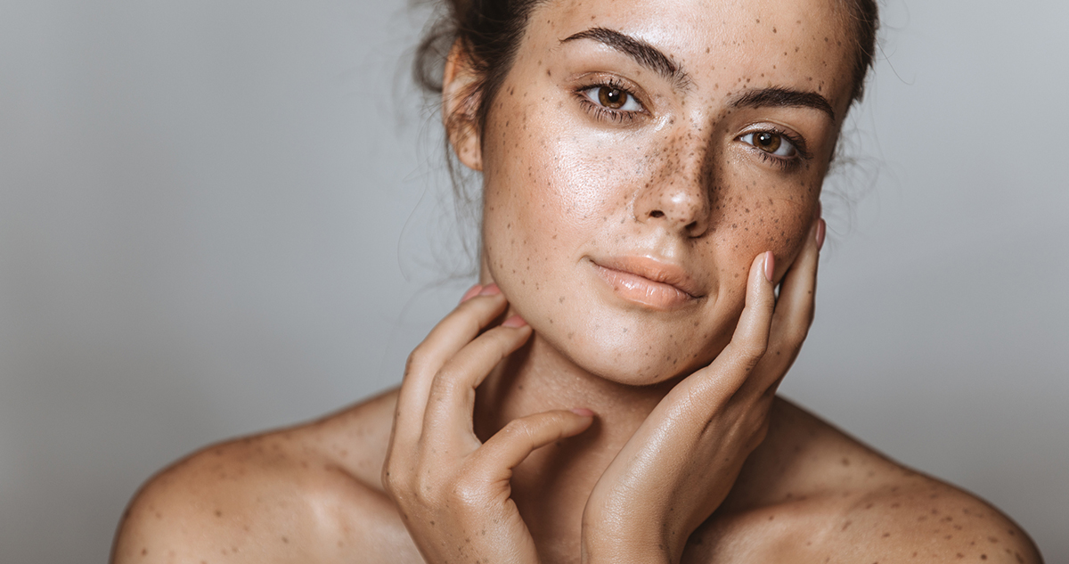 fiatal nő szeplős arcbőr hidratált ragyogó bőr