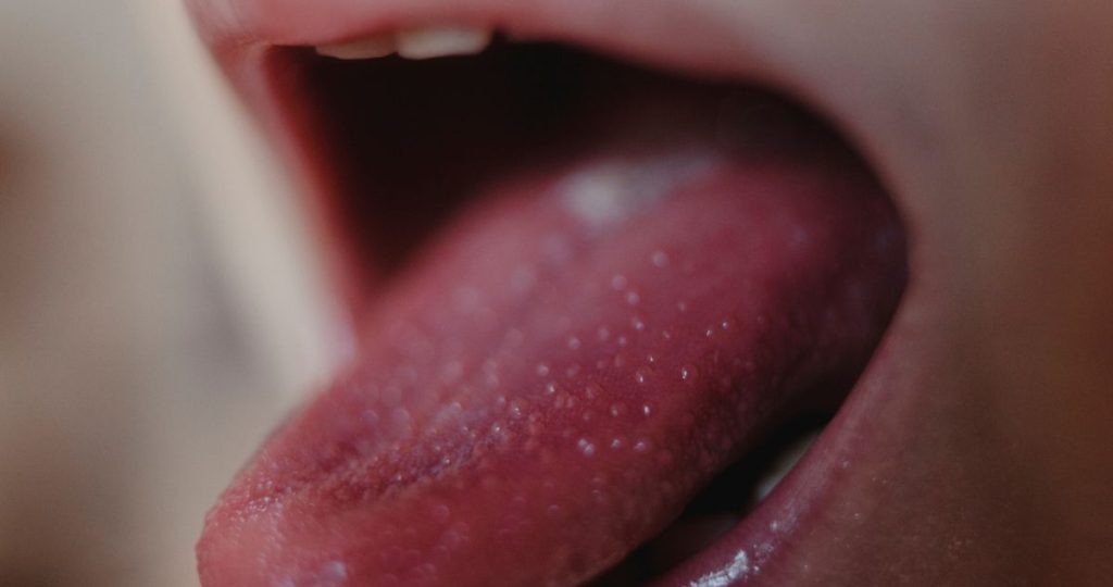 Skarlát: ilyenek a tünetei