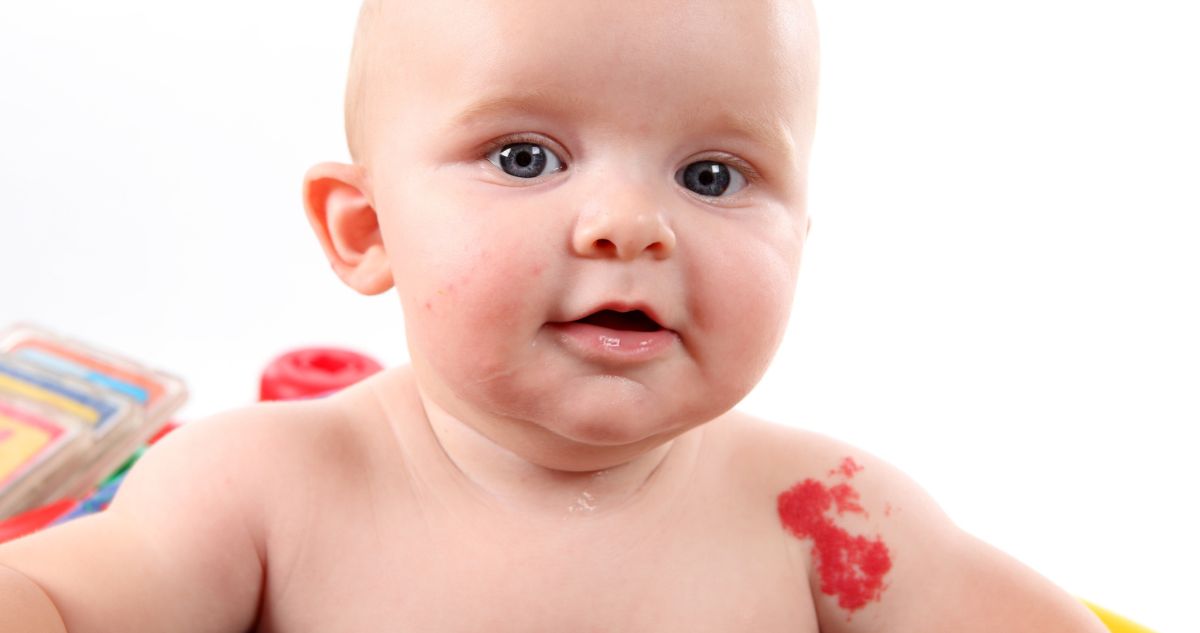 éranyajegy bőrelváltozás