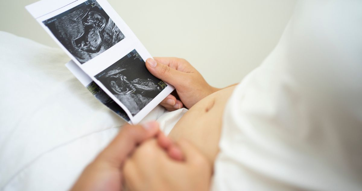 Terhes nő ultrahangfotót tart a kezében