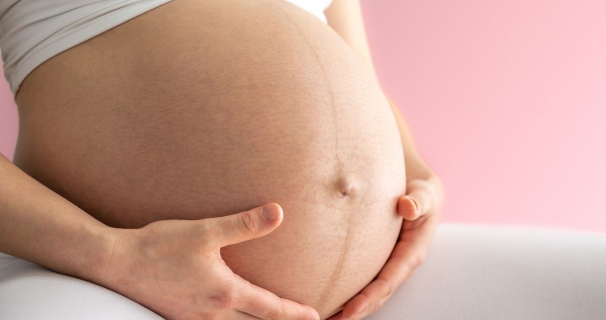 A linea nigra a hason végigfutó sötét csík