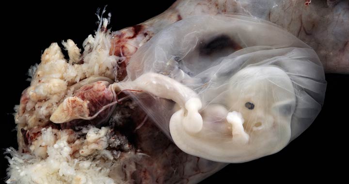 Hihetetlen fotók az anyaméhben fejlődő magzatról
