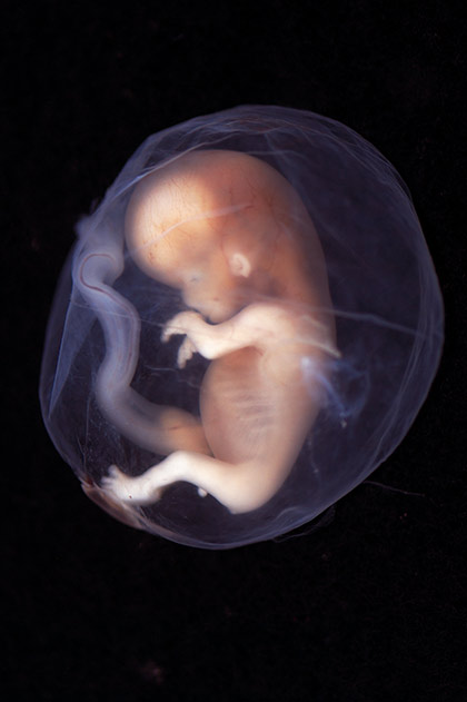 Hihetetlen fotók az anyaméhben fejlődő magzatról