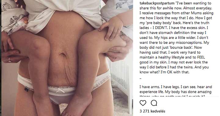Bevállalom, így nézek ki - Szülés utáni képek az Instagramon