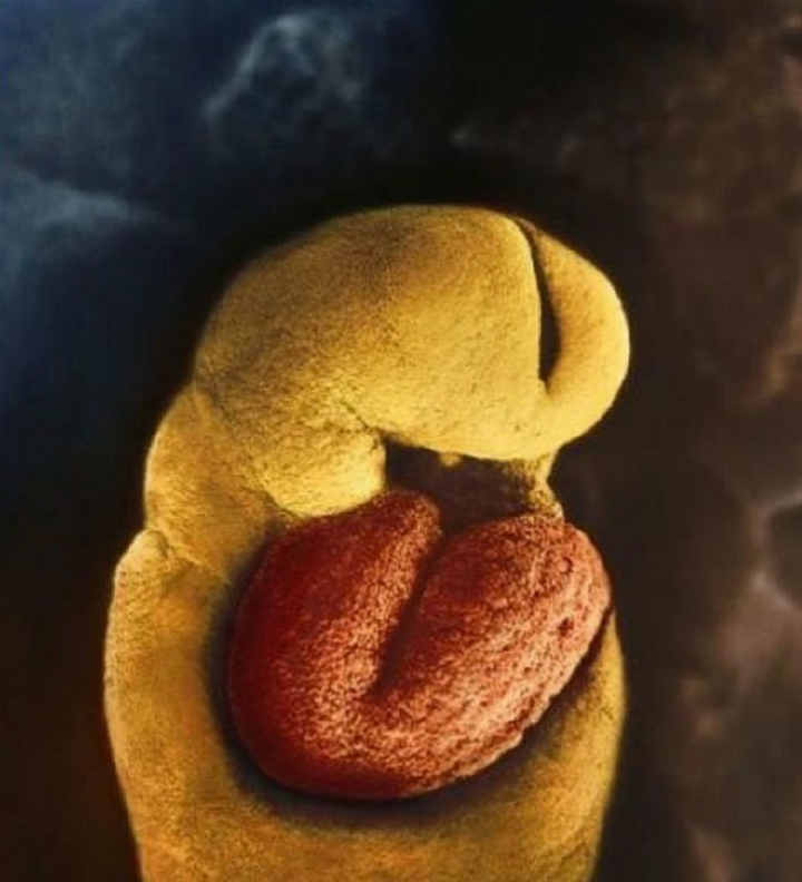 Hogyan fejlődik az embrió? Lenyűgöző fotók